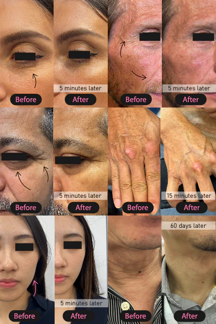 Spacelift Face Booster Lifting Spray - 30ml - Image 4